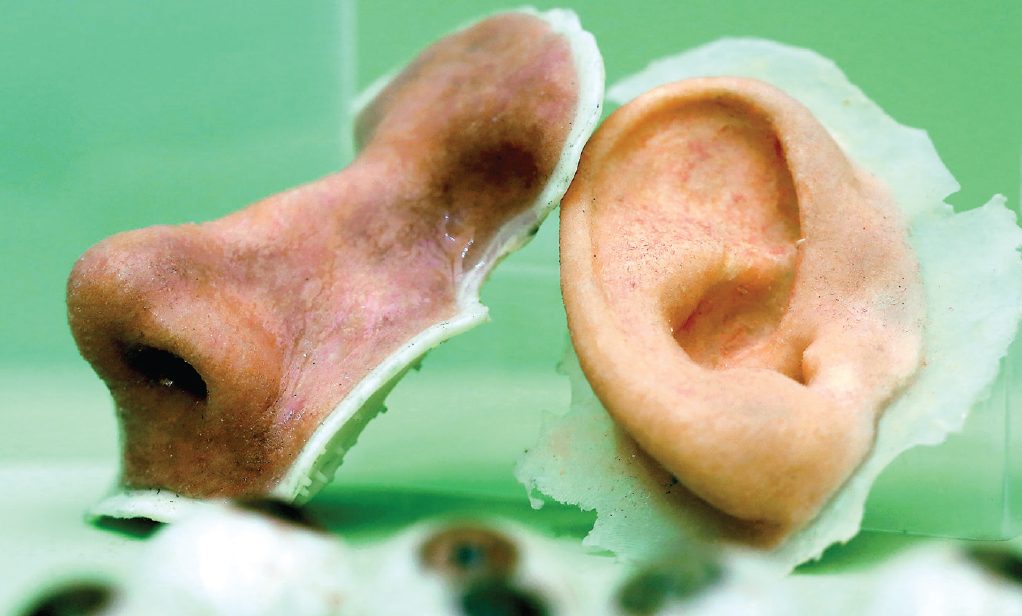 3D printed nose and ear